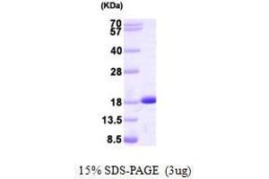 Figure annotation denotes ug of protein loaded and % gel used. (NME2 Protein (AA 1-152))