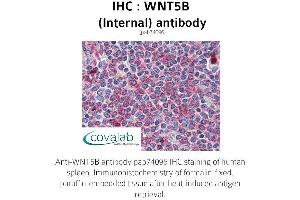Image no. 3 for anti-Wingless-Type MMTV Integration Site Family, Member 5B (WNT5B) (Internal Region) antibody (ABIN1740832) (WNT5B Antikörper  (Internal Region))