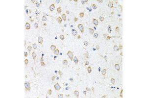 Immunohistochemistry (Paraffin-embedded Sections) (IHC (p)) image for anti-Prokineticin 2 (PROK2) (AA 20-129) antibody (ABIN6146244)