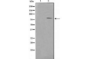 Western blot analysis on Jurkat cell lysate using FER Antibody，The lane on the left is treated with the antigen-specific peptide. (FER Antikörper  (C-Term))