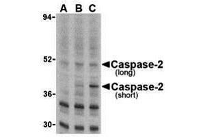 Immunohistochemistry (IHC) image for anti-Caspase 2, Apoptosis-Related Cysteine Peptidase (CASP2) (N-Term) antibody (ABIN1031296) (Caspase 2 Antikörper  (N-Term))