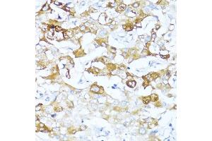 Immunohistochemistry (IHC) image for anti-serpin Peptidase Inhibitor, Clade A (Alpha-1 Antiproteinase, Antitrypsin), Member 3 (SERPINA3) (AA 24-423) antibody (ABIN3016734)