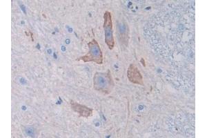 DAB staining on IHC-P; Samples: Rat Spinal cord Tissue (SPTAN1 Antikörper  (AA 1571-1712))