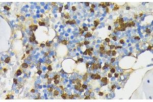 Immunohistochemistry of paraffin-embedded Rat bone marrow using CAMP Polyclonal Antibody at dilution of 1:200 (40x lens). (Cathelicidin Antikörper)