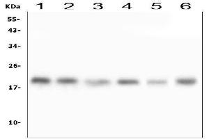 Western blot analysis of RMI2 using anti-RMI2 antibody (ABIN6719656).