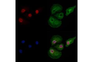 Phospho-Dnmt1 (Ser714) Antibody staining Hela cells(heat shock treatment) by IF/ICC. (DNMT1 Antikörper  (pSer714))