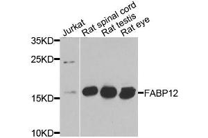 Western blot analysis of extracts of various cell lines, using FABP12 antibody (ABIN6003626) at 1/1000 dilution. (FABP12 Antikörper)