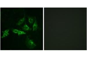 Immunofluorescence analysis of A549 cells, using GNRHR Antibody. (GNRHR Antikörper  (AA 41-90))