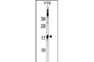 BCL7B Antibody (C-term) (ABIN1536707 and ABIN2848811) western blot analysis in Y79 cell line lysates (35 μg/lane). (BCL7B Antikörper  (C-Term))