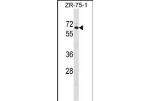 SRPR Antibody (C-term) (ABIN1537353 and ABIN2849199) western blot analysis in ZR-75-1 cell line lysates (35 μg/lane). (SRPR Antikörper  (C-Term))