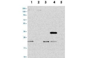 Western blot analysis of Lane 1: RT-4, Lane 2: U-251 MG, Lane 3: Human Plasma, Lane 4: Liver, Lane 5: Tonsil with PTCD2 polyclonal antibody . (PTCD2 Antikörper)