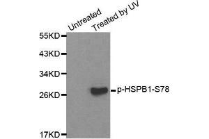 Western blot analysis of extracts from HL60 cells, using Phospho-HSPB1-S78 antibody. (HSP27 Antikörper  (pSer78))