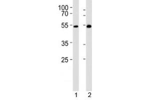 Western blot analysis of lysate from 1) mouse thymus and 2) rat thymus tissue lysate using LCK antibody at 1:1000.