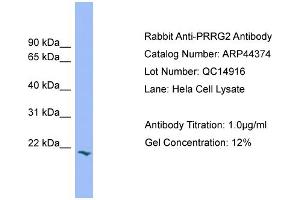WB Suggested Anti-PRRG2  Antibody Titration: 0. (PRRG2 Antikörper  (Middle Region))