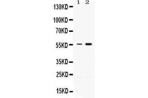 Western blot analysis of MEF2A expression in rat thymus extract ( Lane 1) and HELA whole cell lysates ( Lane 2).