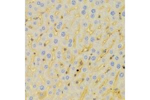 Immunohistochemistry of paraffin-embedded Mouse liver using PCM1 antibody at dilution of 1:100 (x400 lens). (PCM1 Antikörper)