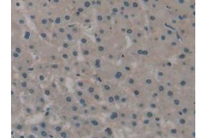 Immunohistochemistry (IHC) image for anti-ATPase, Na+/K+ Transporting, beta 3 Polypeptide (ATP1B3) (AA 61-273) antibody (ABIN7440134)