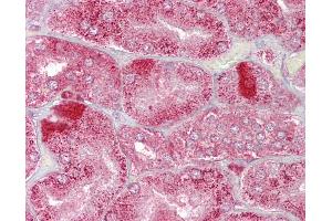 Anti-AMACR antibody IHC of human kidney. (AMACR Antikörper  (AA 286-335))