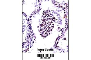 NFKBIB Antibody immunohistochemistry analysis in formalin fixed and paraffin embedded human lung tissue followed by peroxidase conjugation of the secondary antibody and DAB staining. (NFKBIB Antikörper  (C-Term))