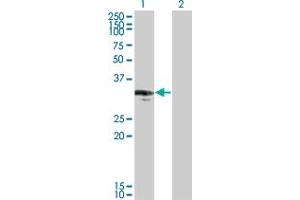 Western Blot analysis of CENPP expression in transfected 293T cell line by CENPP monoclonal antibody (M07), clone 3G8.