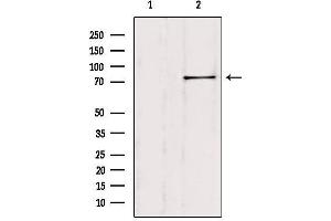 Western blot analysis of extracts from Hela, using SH2B1 Antibody. (SH2B1 Antikörper  (Internal Region))
