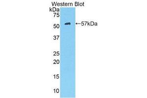 Western Blotting (WB) image for anti-Hexokinase 2 (HK2) (AA 605-868) antibody (ABIN3204499) (Hexokinase 2 Antikörper  (AA 605-868))