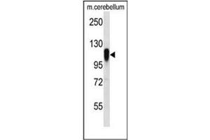 Western blot analysis of FBXO41 Antibody (N-term) in mouse cerebellum tissue lysates (35ug/lane). (FBXO41 Antikörper  (N-Term))