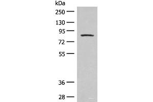 Western blot analysis of Mouse brain tissue lysate using PFKM Polyclonal Antibody at dilution of 1:350 (PFKM Antikörper)