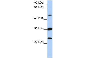 WB Suggested Anti-XK Antibody Titration:  0. (Membrane transport protein XK (XK) (N-Term) Antikörper)