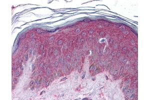 Immunohistochemistry (IHC) image for anti-APC Regulator of WNT Signaling Pathway 2 (APC2) (Middle Region) antibody (ABIN2784219) (APC2 Antikörper  (Middle Region))