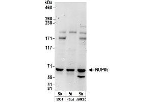 anti-Nucleoporin 85kDa (NUP85) (AA 575-625) antibody