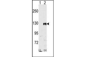 Western blot analysis of EphB1 (arrow) using rabbit polyclonal EphB1 Antibody. (EPH Receptor B1 Antikörper)