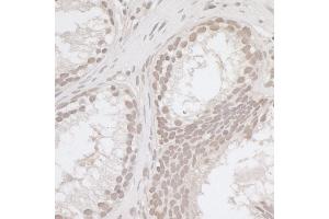 Immunohistochemistry (IHC) image for anti-E2F Transcription Factor 4, P107/p130-Binding (E2F4) (AA 363-413) antibody (ABIN7454807)