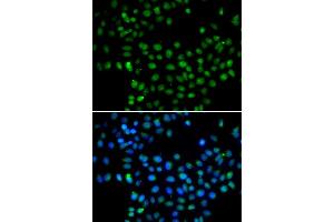 Immunofluorescence analysis of A549 cells using EAF2 antibody (ABIN5974281). (EAF2 Antikörper)