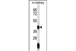 GTPBP10 Antibody (C-term) (ABIN656643 and ABIN2845886) western blot analysis in mouse kidney tissue lysates (35 μg/lane). (GTPBP10 Antikörper  (C-Term))