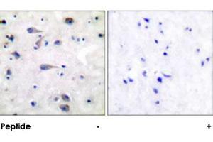 Immunohistochemical analysis of paraffin-embedded human brain tissue using OPRM1 polyclonal antibody .