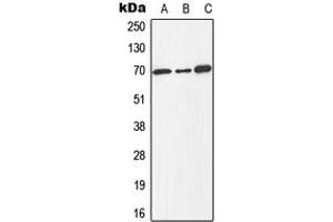 Western blot analysis of E2F1 (pT433) expression in Jurkat colchicine-treated (A), mouse spleen (B), PC12 colchicine-treated (C) whole cell lysates. (E2F1 Antikörper  (C-Term, pSer433))