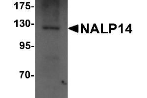 Western blot analysis of NALP14 in rat brain tissue lysate with NALP14 antibody at 1 µg/mL.