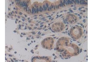 Detection of PDHX in Mouse Uterus Tissue using Polyclonal Antibody to Pyruvate Dehydrogenase Complex Component X (PDHX)