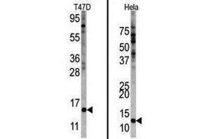 Image no. 1 for anti-Finkel-Biskis-Reilly Murine Sarcoma Virus (FBR-MuSV) Ubiquitously Expressed (FAU) (Center) antibody (ABIN357137) (FAU Antikörper  (Center))