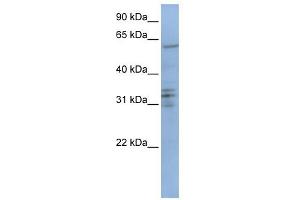 CENPB antibody used at 1 ug/ml to detect target protein.