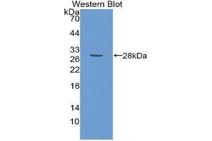 Western Blotting (WB) image for anti-GATA Binding Protein 1 (Globin Transcription Factor 1) (GATA1) (AA 150-384) antibody (ABIN1980403) (GATA1 Antikörper  (AA 150-384))