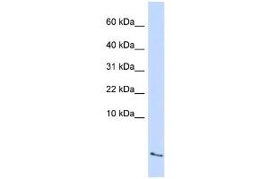WB Suggested Anti-SAA4 Antibody Titration:  0. (SAA4 Antikörper  (Middle Region))