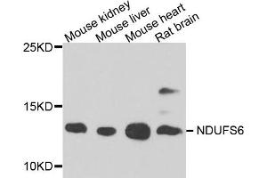 Western blot analysis of extract of various cells, using NDUFS6 antibody.