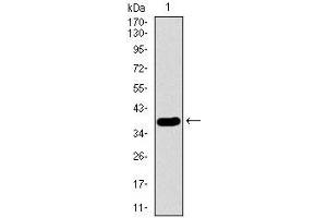 Western blot analysis using SFTPC mAb against human SFTPC recombinant protein. (Surfactant Protein C Antikörper  (AA 60-180))