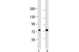 ABCD1 antibody western blot analysis in human 1) 293/T17 and 2) HL-60 lysate. (ABCD1 Antikörper  (AA 257-285))