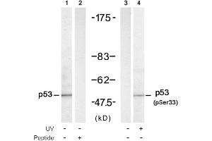 Image no. 1 for anti-Tumor Protein P53 (TP53) (Ser33) antibody (ABIN319306) (p53 Antikörper  (Ser33))