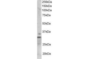 ABIN185246 staining (1µg/ml) of Mouse Heart lysate (RIPA buffer, 35µg total protein per lane).