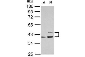 WB Image Sample (30 ug of whole cell lysate) A: Raji B: K562 10% SDS PAGE antibody diluted at 1:1000 (APOL1 Antikörper)