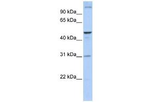 ACBD5 antibody used at 1 ug/ml to detect target protein. (ACBD5 Antikörper  (N-Term))